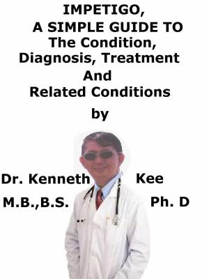 Cover of the book Impetigo, A Simple Guide To The Condition, Diagnosis, Treatment And Related Conditions by Kenneth Kee