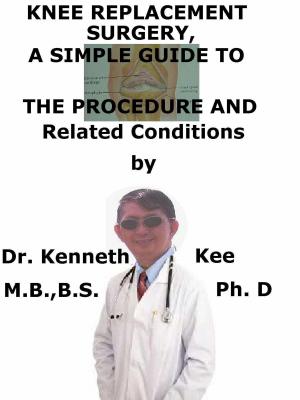 Book cover of Knee Replacement Surgery, A Simple Guide To The Procedure And Related Conditions