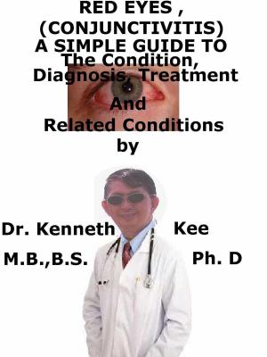 Cover of the book Red Eyes (Conjunctivitis), A Simple Guide To The Condition, Diagnosis, Treatment And Related Conditions by Kenneth Kee