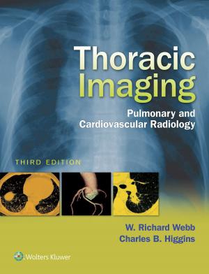 Cover of the book Thoracic Imaging by Charles B. Higgins, Albert de Roos