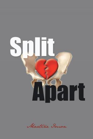 Cover of the book Split Apart by Angela Cooke