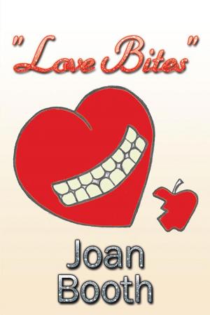 Cover of the book "Love Bites" by Kernstly