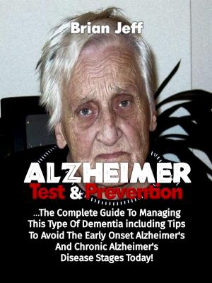 bigCover of the book Alzheimers Test And Prevention: The Complete Guide To Managing This Type Of Dementia Including Tips To Avoid The Early Onset Alzheimer's And Chronic Alzheimer's Disease Stages Today! by 