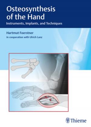 Cover of the book Osteosynthesis of the Hand by Jan Ekstrand, Markus Walden, Peter Ueblacker