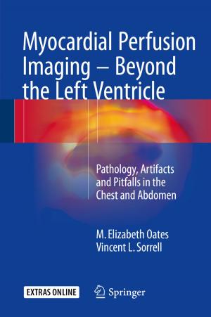 Cover of the book Myocardial Perfusion Imaging - Beyond the Left Ventricle by Angela Hilmi
