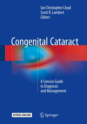 Cover of the book Congenital Cataract by Clifford J. Cunningham