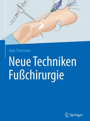 Cover of the book Neue Techniken Fußchirurgie by Ralph Jürgen Bährle