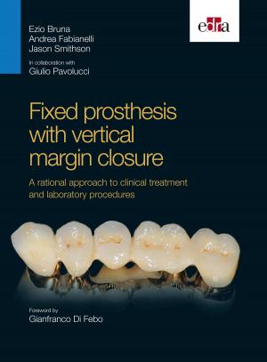 Cover of the book Fixed prosthesis with vertical margin closure by Mark W. Holladay, Richard B. Silverman