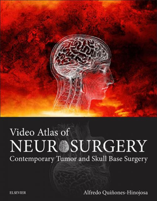 Cover of the book Video Atlas of Neurosurgery E-Book by Alfredo Quinones-Hinojosa, MD, FAANS, FACS, Elsevier Health Sciences