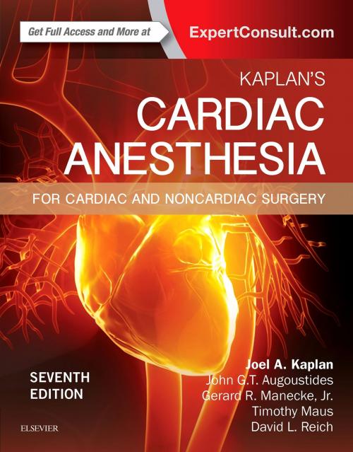 Cover of the book Kaplan's Cardiac Anesthesia E-Book by Joel A. Kaplan, MD, Elsevier Health Sciences