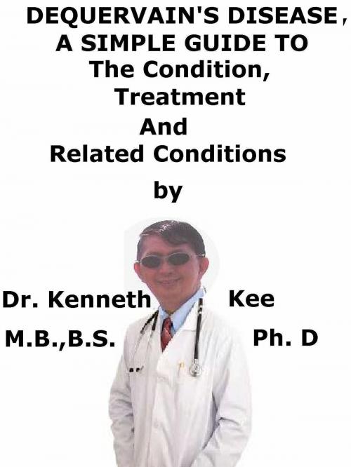 Cover of the book DeQuervain Disease, A Simple Guide To The Condition, Treatment And Related Conditions by Kenneth Kee, Kenneth Kee