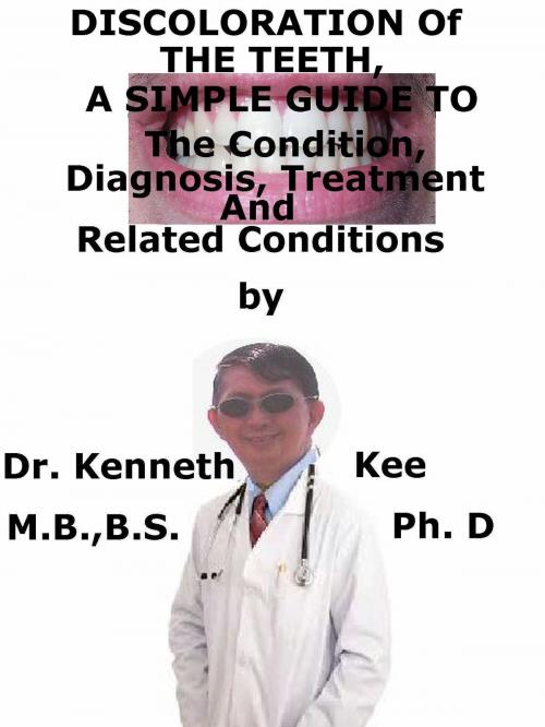 Cover of the book Discoloration of The Teeth, A Simple Guide To The Condition, Diagnosis, Treatment And Related Conditions by Kenneth Kee, Kenneth Kee
