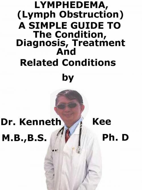 Cover of the book Lymphedema (Lymph Obstruction), A Simple Guide To The Condition, Diagnosis, Treatment And Related Conditions by Kenneth Kee, Kenneth Kee