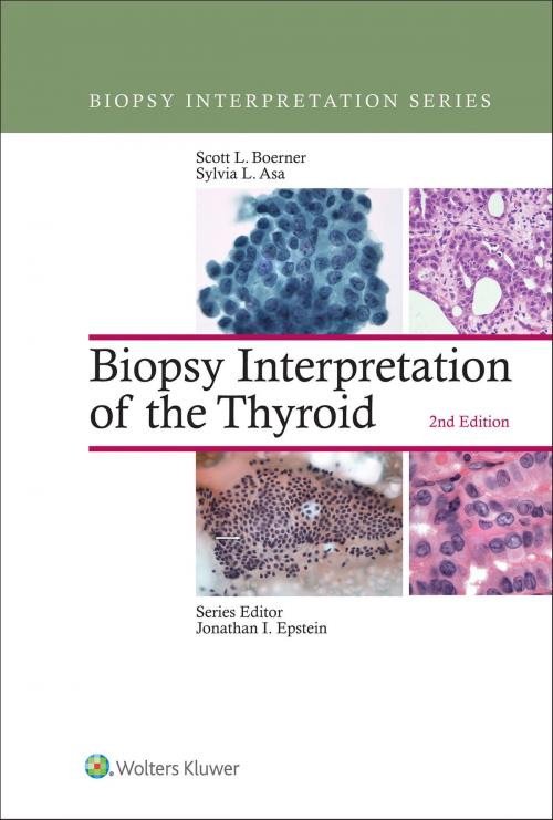 Cover of the book Biopsy Interpretation of the Thyroid by Scott L. Boerner, Sylvia L. Asa, Wolters Kluwer Health
