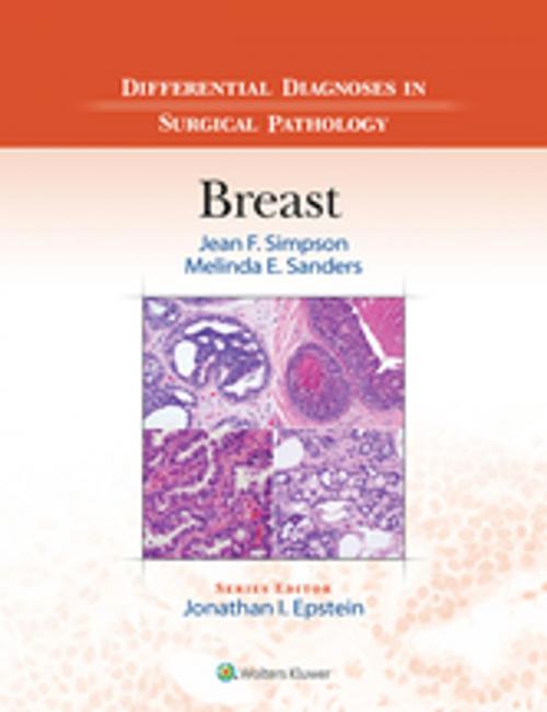 Cover of the book Differential Diagnoses in Surgical Pathology: Breast by Jean F. Simpson, Melinda E. Sanders, Wolters Kluwer Health