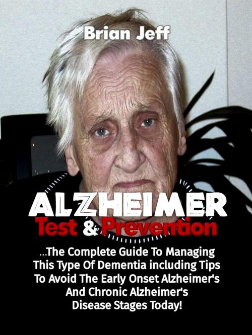 Cover of the book Alzheimers Test And Prevention: The Complete Guide To Managing This Type Of Dementia Including Tips To Avoid The Early Onset Alzheimer's And Chronic Alzheimer's Disease Stages Today! by Brian Jeff, Eljays-epublishing