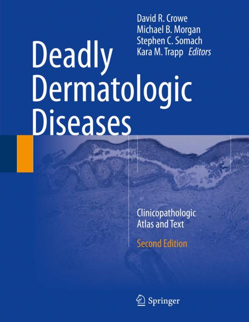 Cover of the book Deadly Dermatologic Diseases by , Springer International Publishing
