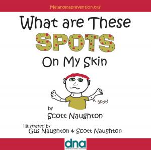 bigCover of the book What are These Spots on My Skin by 