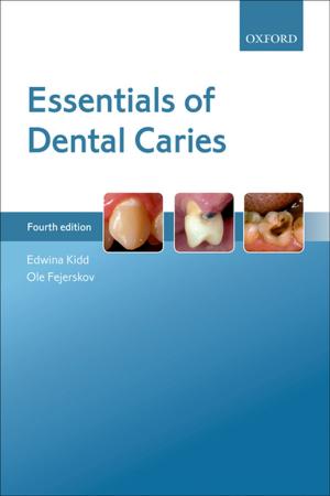 Cover of the book Essentials of Dental Caries by Derek Parfit