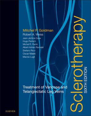 Cover of the book Sclerotherapy E-Book by James C Reynolds, MD