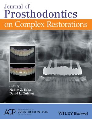 Cover of the book Journal of Prosthodontics on Complex Restorations by John E. Triantis