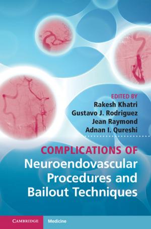 Cover of the book Complications of Neuroendovascular Procedures and Bailout Techniques by LaSalle D. Leffall Jr., Margaret L. Kripke, PhD