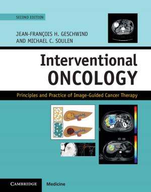Cover of the book Interventional Oncology by Tirthankar Roy