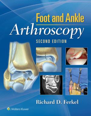 Cover of the book Foot & Ankle Arthroscopy by M. Laurin Council, David Sheinbein, Lynn A. Cornelius