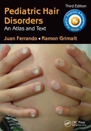 Cover of the book Pediatric Hair Disorders by Victor A. Bloomfield