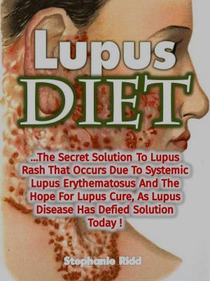 Cover of Lupus Diet: The Secret Solution To Lupus Rash That Occurs Due To Systemic Lupus Erythematosus And The Hope For Lupus Cure, As Lupus Disease Has Defied Solution Today!