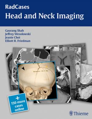 Cover of the book Head and Neck Imaging by C. Richard Goldfarb, Murthy R. Chamarthy, Fukiat Ongseng