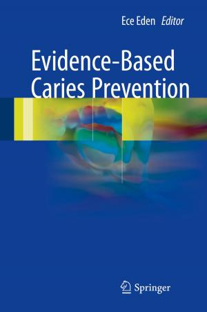 Cover of the book Evidence-Based Caries Prevention by 