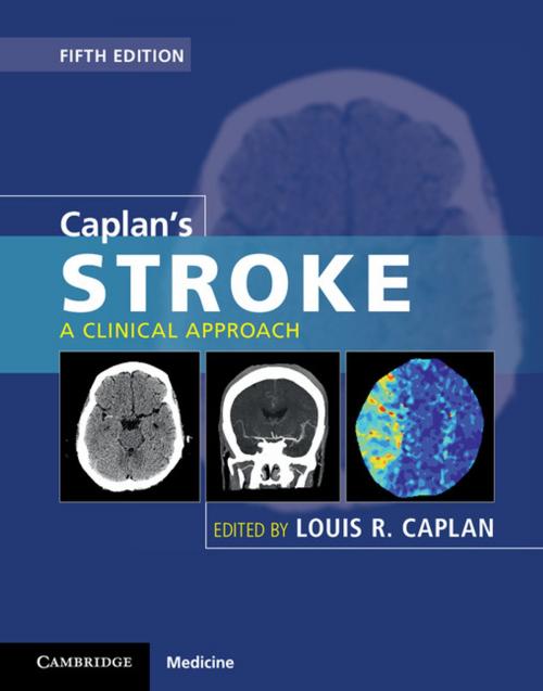 Cover of the book Caplan's Stroke by , Cambridge University Press