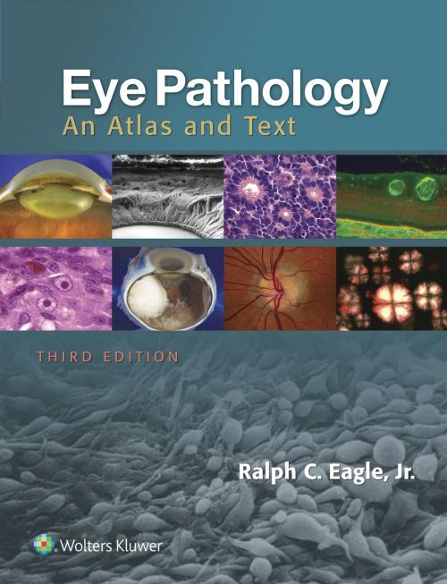 Cover of the book Eye Pathology by Ralph C. Eagle, Jr., Wolters Kluwer Health
