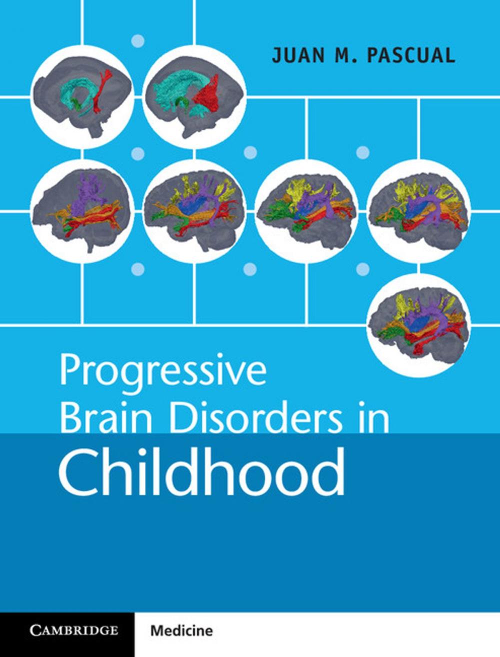 Big bigCover of Progressive Brain Disorders in Childhood