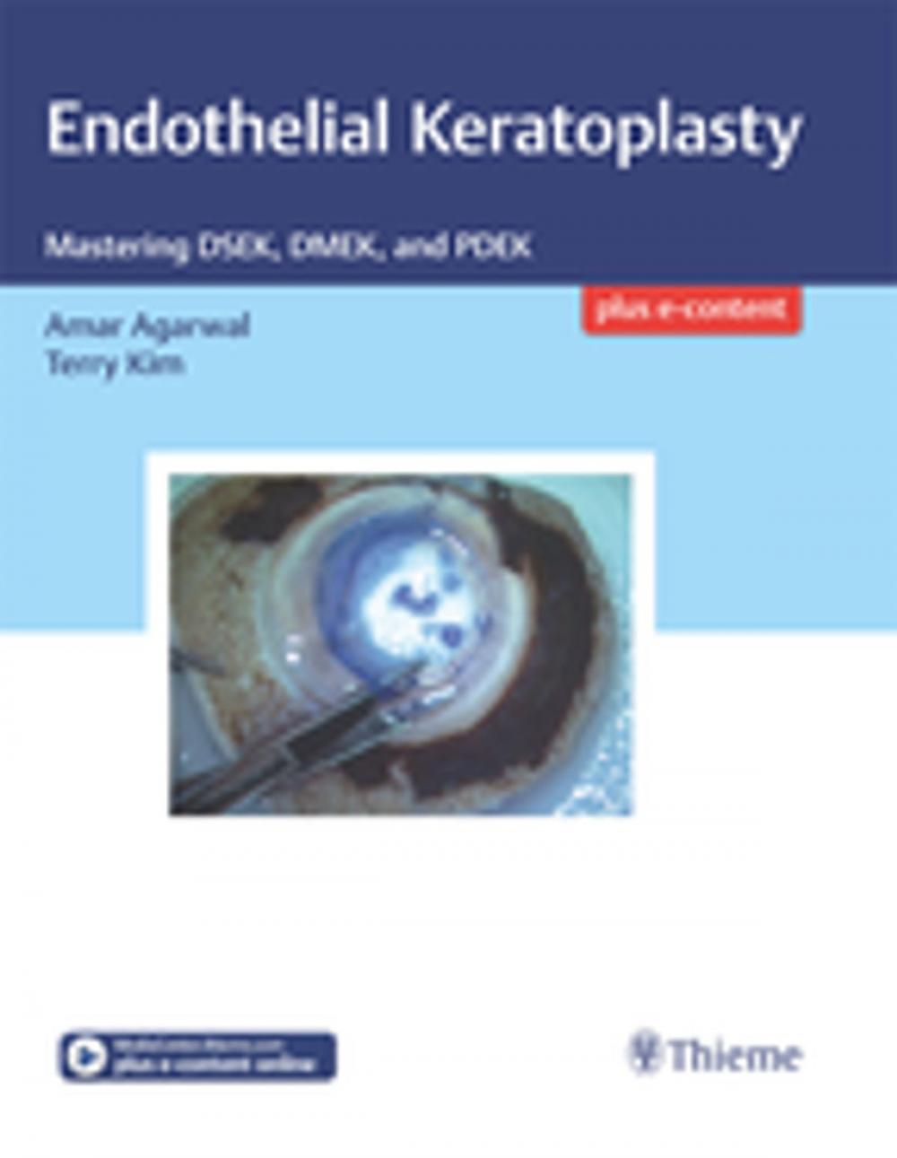 Big bigCover of Endothelial Keratoplasty