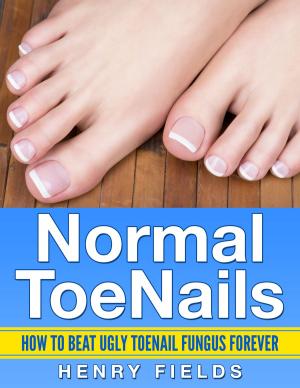 Book cover of Normal ToeNails