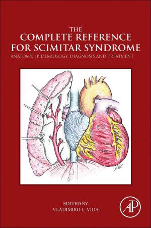Cover of the book The Complete Reference for Scimitar Syndrome by Bingxin Wu