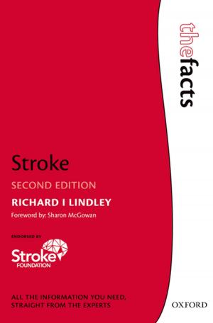Cover of the book Stroke by John Polidori
