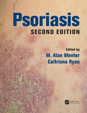 Cover of the book Psoriasis by R.A. Mackay, W. Henderson