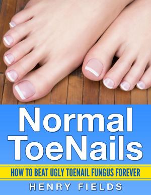 Book cover of Normal ToeNails: How to Beat Ugly Toenail Fungus Forever