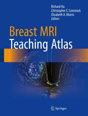 Cover of the book Breast MRI Teaching Atlas by Sana Loue