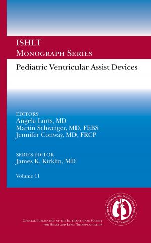 Cover of the book Pediatric Ventricular Assist Devices by Dixie Webb