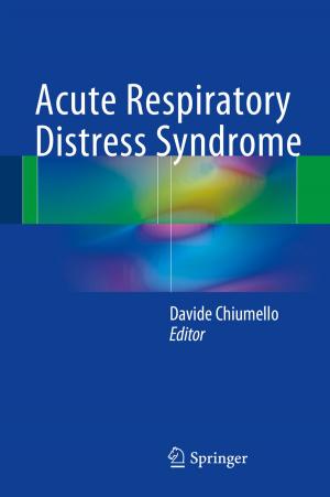 bigCover of the book Acute Respiratory Distress Syndrome by 