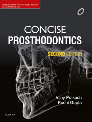 Cover of the book Concise Prosthodontics- E Book by Alejandro A Rabinstein, Alireza Minagar, MD, FAAN