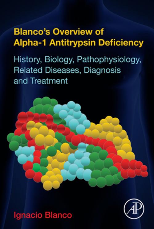 Cover of the book Blanco's Overview of Alpha-1 Antitrypsin Deficiency by Ignacio Blanco, MD, Elsevier Science