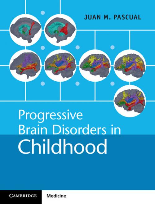 Cover of the book Progressive Brain Disorders in Childhood by Juan M. Pascual, Cambridge University Press