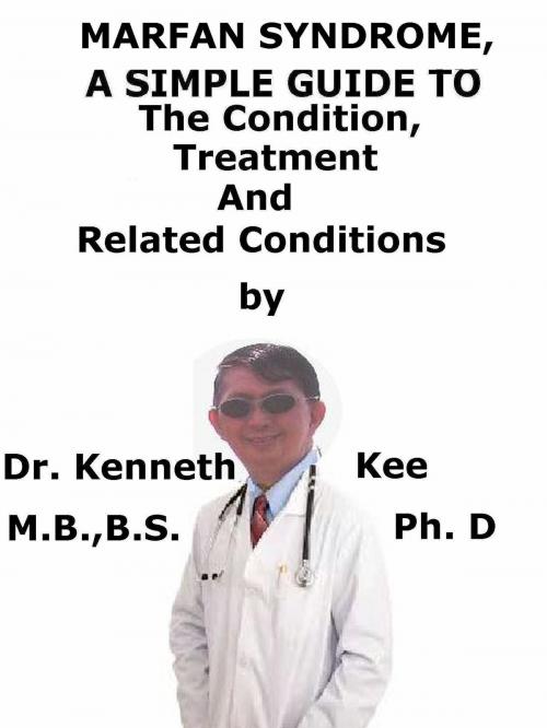 Cover of the book Marfan Syndrome, A Simple Guide To The Condition, Treatment And Related Conditions by Kenneth Kee, Kenneth Kee