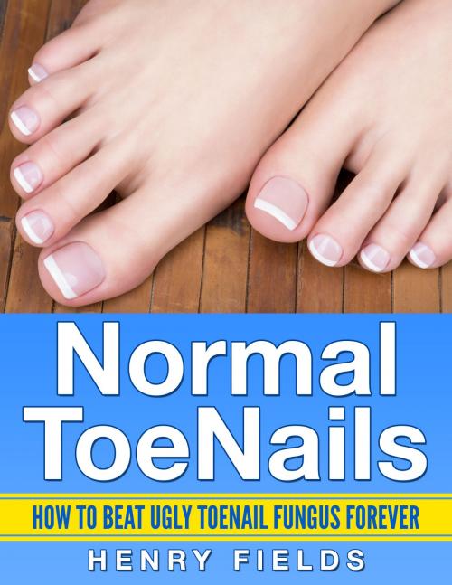 Cover of the book Normal ToeNails: How to Beat Ugly Toenail Fungus Forever by Henry Fields, Henry Fields