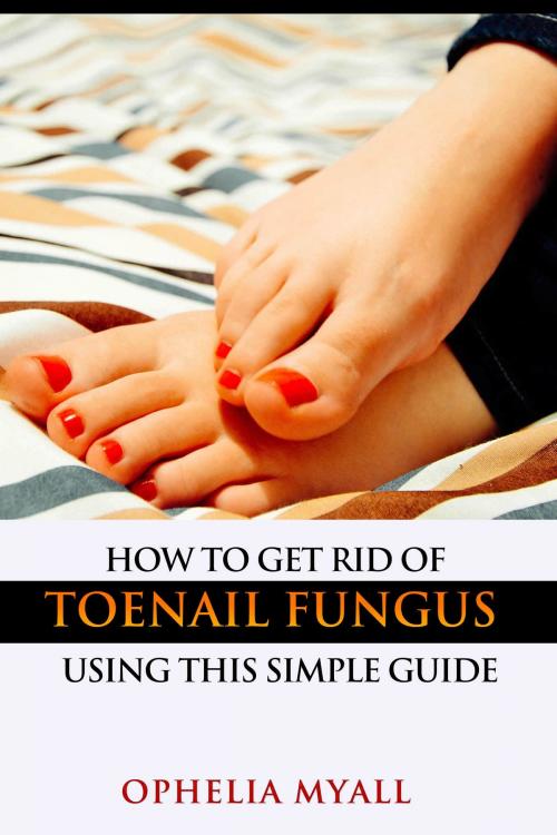 Cover of the book How to Get Rid of Toenail Fungus Using This Simple Guide by Ophelia Myall, Ophelia Myall